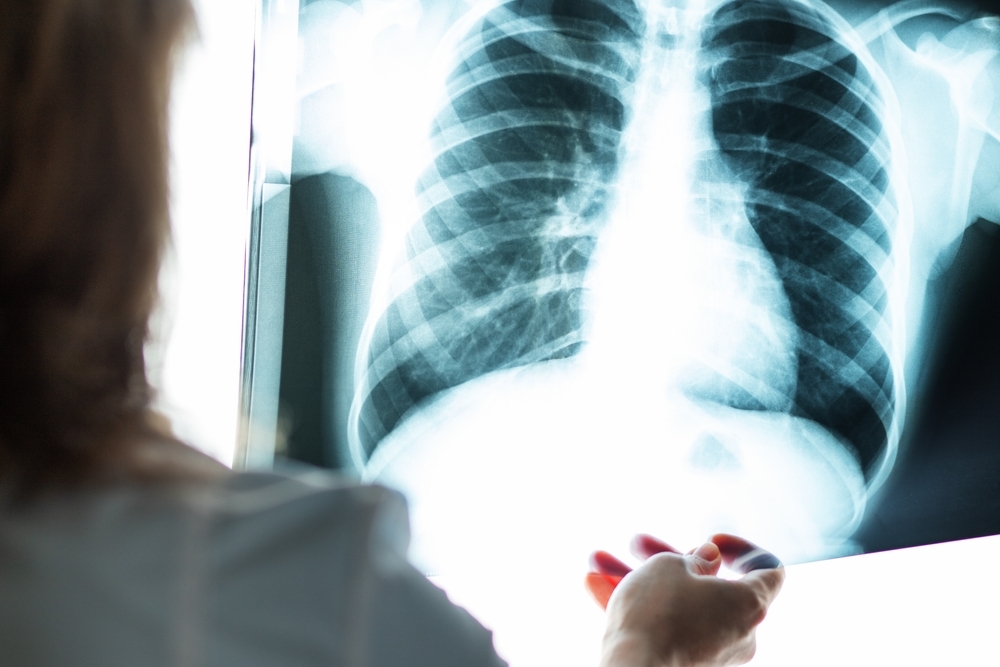 Was ist Thoraxchirurgie?