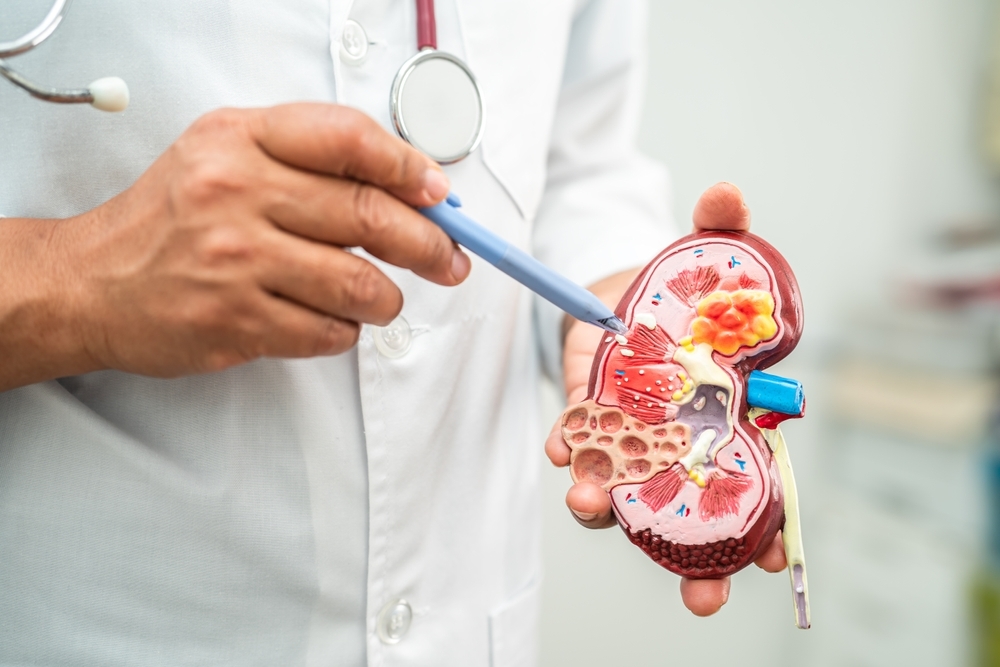 Was ist ein Nephrologe?