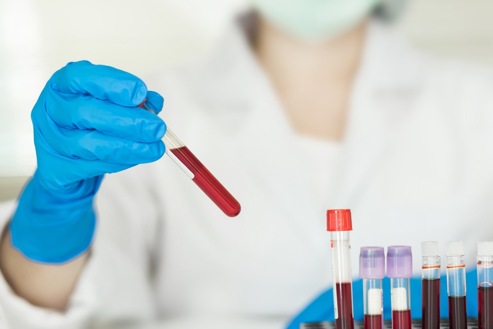 Was macht ein Transfusionsmediziner?